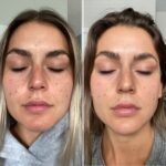 BBL/IPL (Lumecca peak)