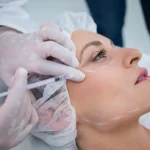 Botulinum toksin uygulamaları