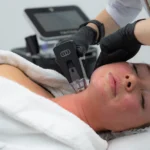 Altın iğneli radyofrekans (Morpheus8)